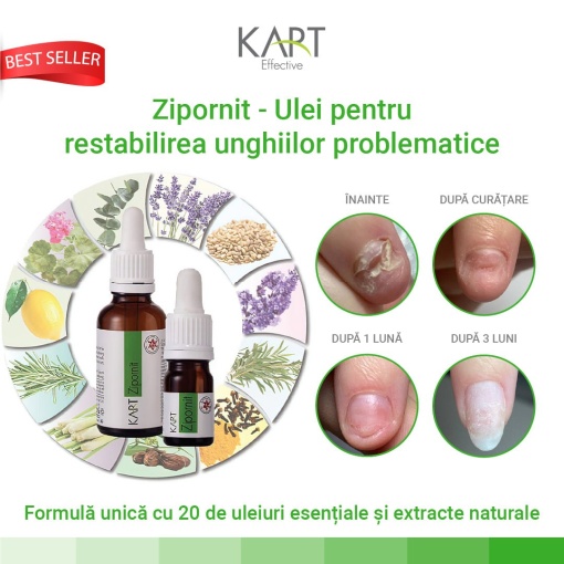 Zipornit KART - 30ml (7006)