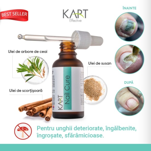 Nail Cure - Solutie Antimicotica pentru Unghii KART - 15ml (7706)