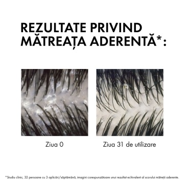 Rezerva eco sampon anti-matreata pentru par normal-gras Dercos, 390 ml, Vichy - Img 7