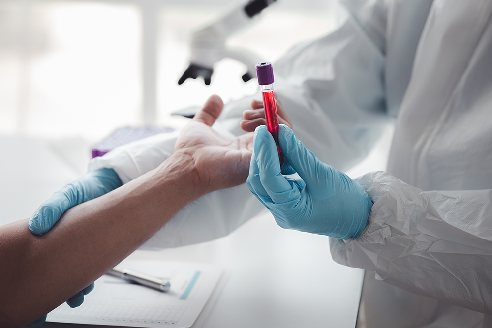 Proteina C-reactivă (CRP): Ce indică analiza, valori normale și cauze ale valorilor crescute