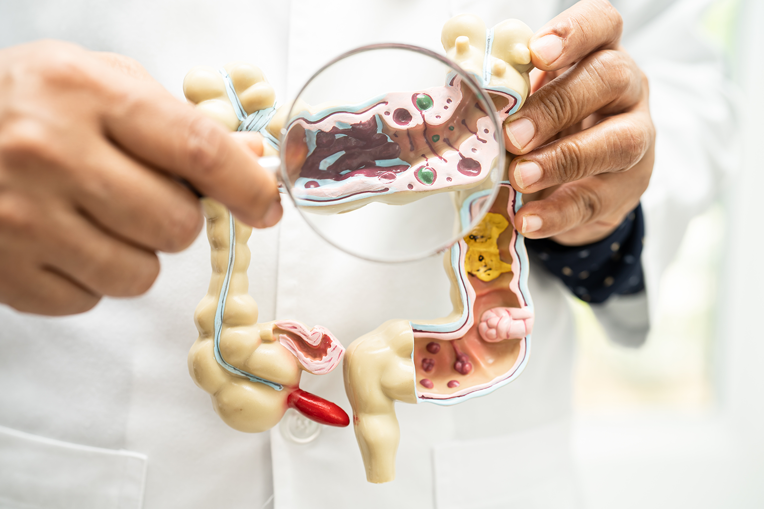 Ce este microbiomul intestinal și de ce este esențial pentru sănătate