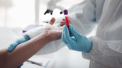 Proteina C-reactivă (CRP): Ce indică analiza, valori normale și cauze ale valorilor crescute