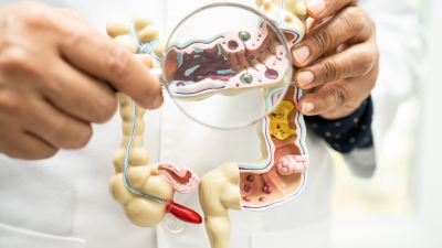 Ce este microbiomul intestinal și de ce este esențial pentru sănătate