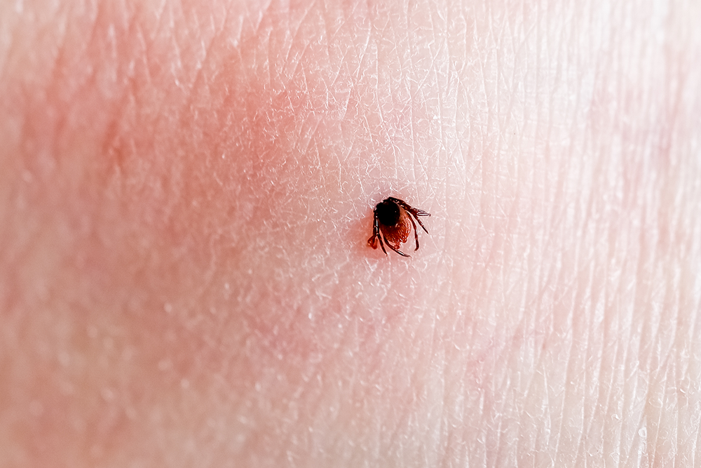 capusa imfipta pe piele