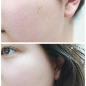 Toner exfoliant cu AHA si BHA 150ml (Cosrx) - Img 2