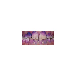 Tablete revelatoare placa bacteriana, 10 bucati, Curaprox - Img 3