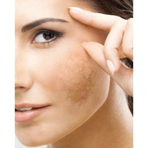 Crema Triderm AK SPF50+, 50ml, BioNike - Img 2