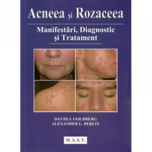 Acneea si rozaceea - Manifestari, diagnostic si tratament, MAST